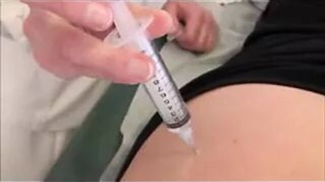 Injection 1